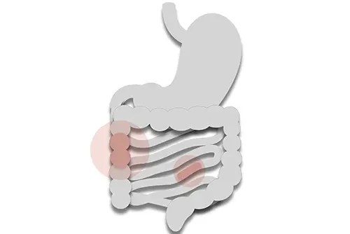 Enfermedad Inflamatorias del intestino espacialidades del Instituto Clinico del Aparato digestivo web