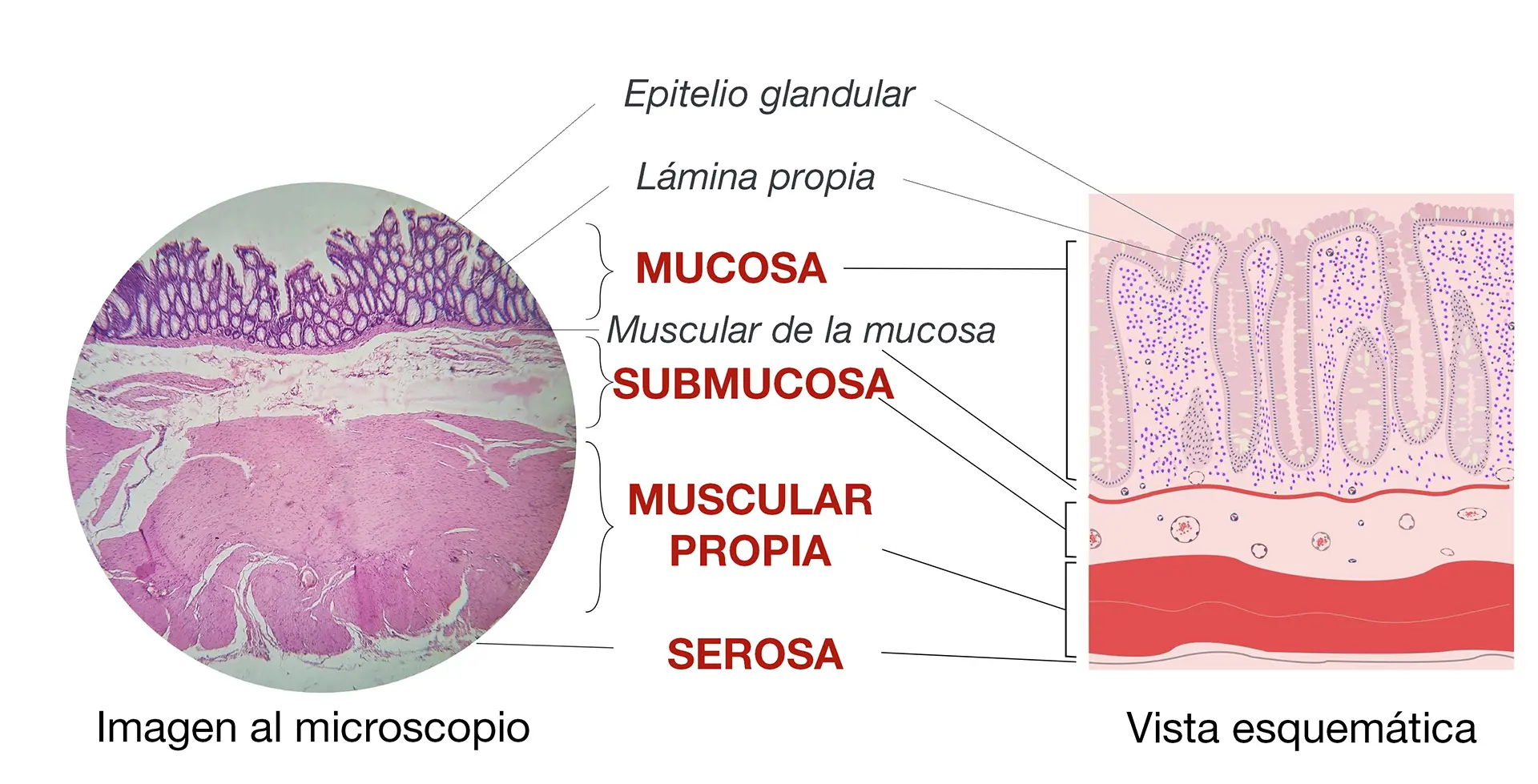 Capas pared colon icadig