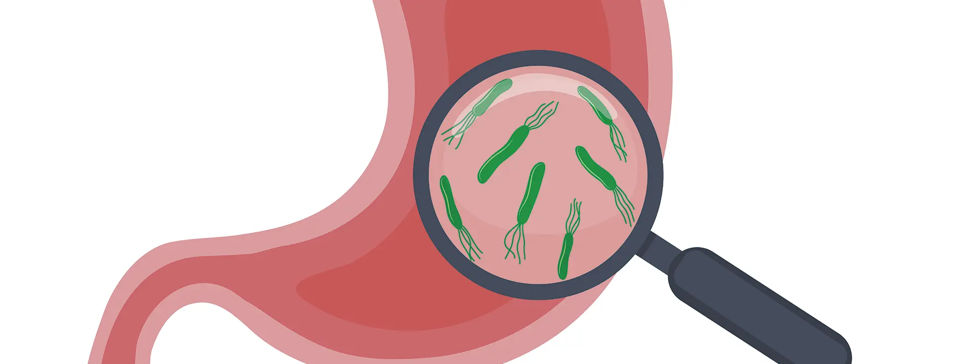 Helicobacter pylori icadig