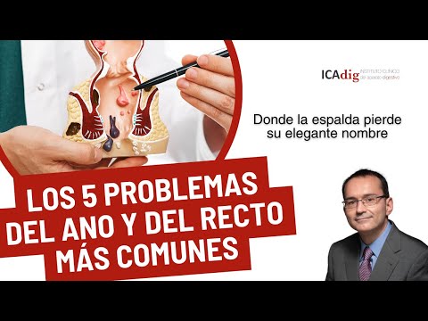 Enfermedades del ano fotos