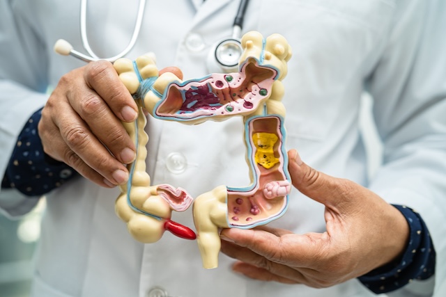 Intestine, appendix and digestive system, doctor holding anatomy model for study diagnosis and treatment in hospital.