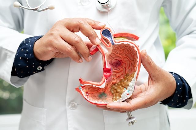 Stomach disease, doctor holding anatomy model for study diagnosis and treatment in hospital.