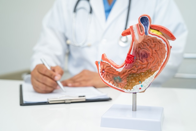 Stomach disease, doctor with anatomy model for study diagnosis and treatment in hospital.