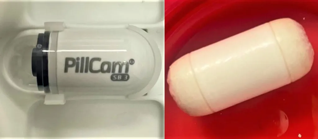 Comparativas de pildoras endoscopicas intestinales con camara y de prueba efe 1024x447