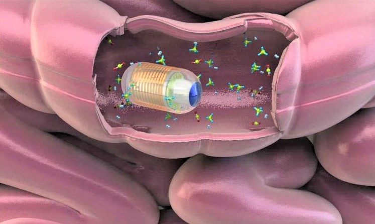 capsula endoscopica intestinal 2