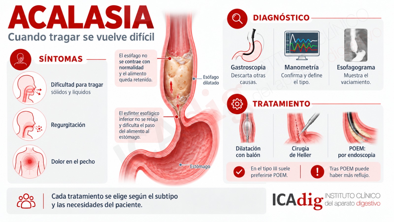 Infografía sobre la acalasia: qué falla en el esófago, síntomas, diagnóstico por manometría y tratamiento con dilatación, cirugía de Heller o POEM
